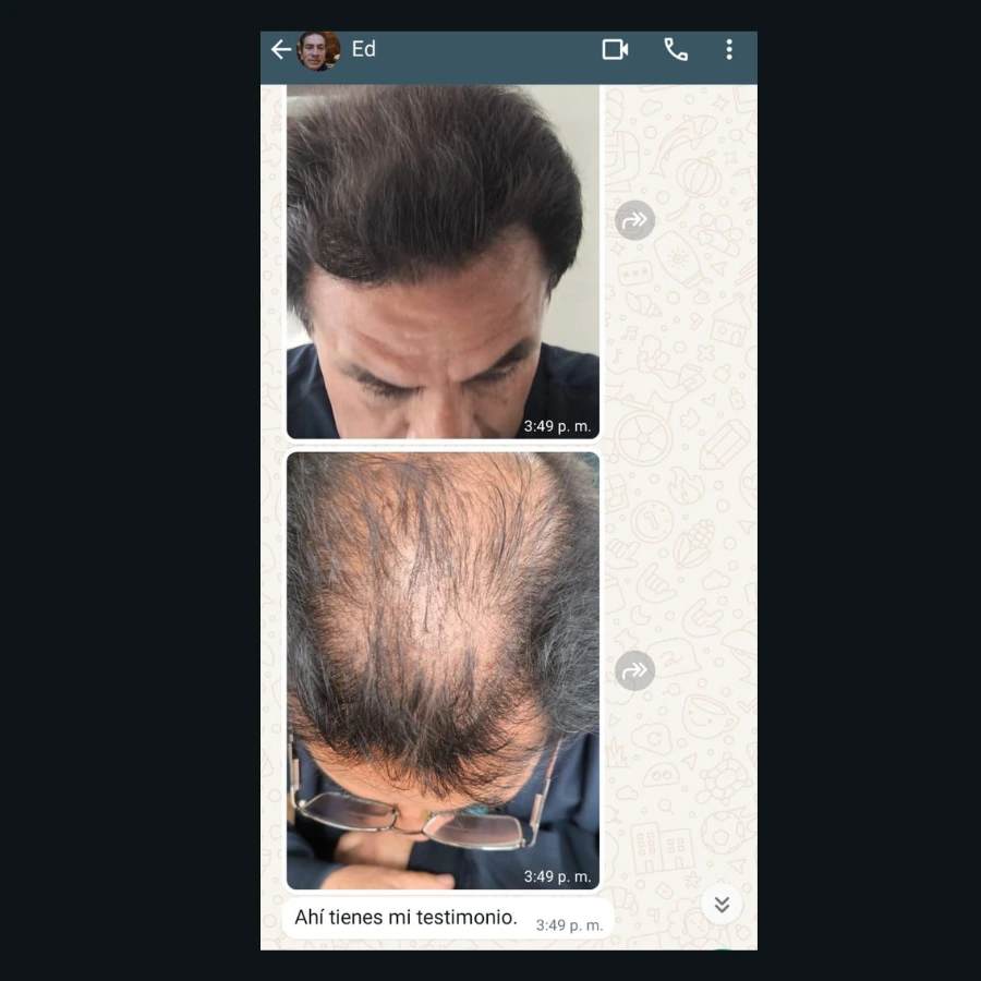 Testimonio 4